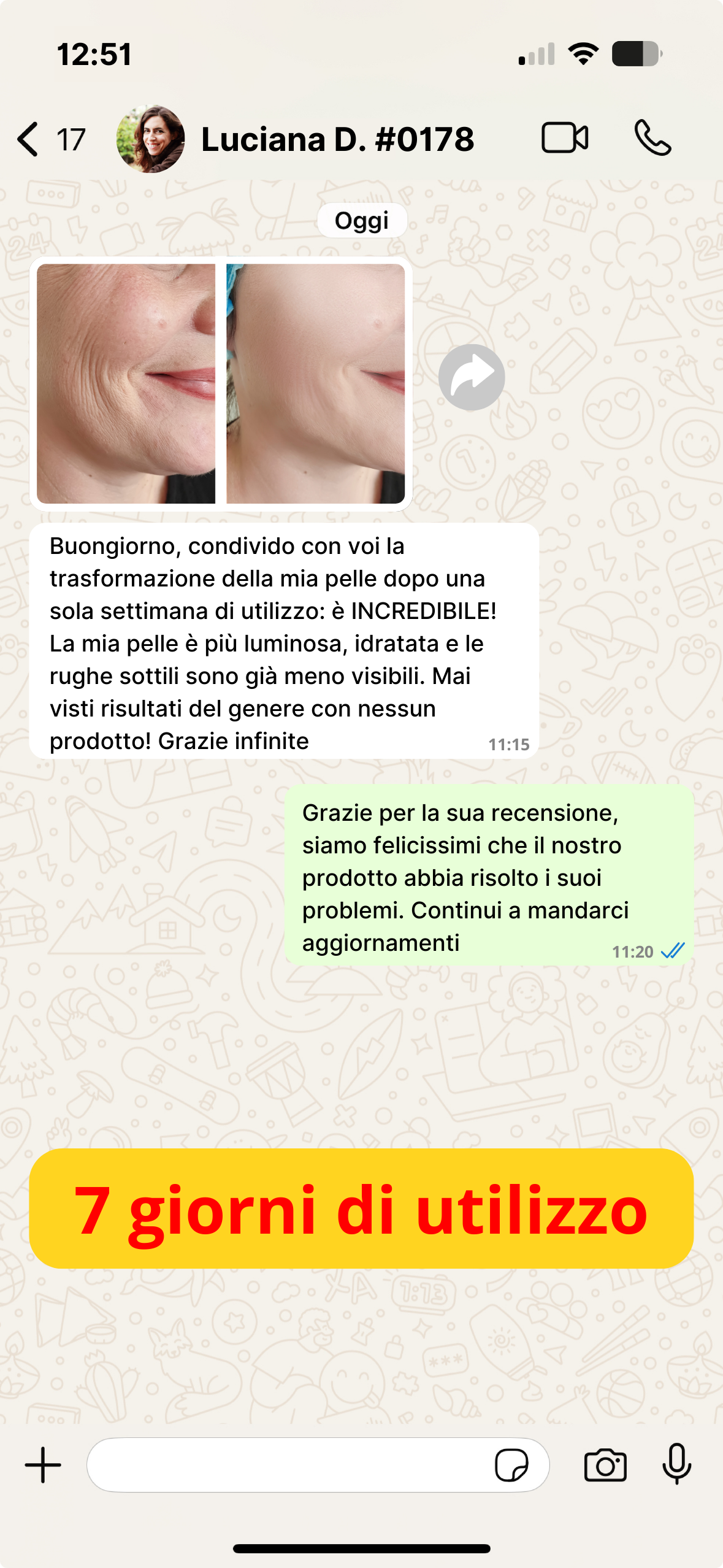 Antiage